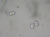 Pachyella babingtonii image