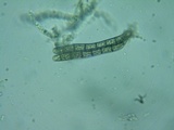 Lasiosphaeria hirsuta image