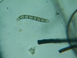 Lasiosphaeria hirsuta image