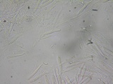 Orbilia sarraziniana image