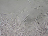 Orbilia sarraziniana image