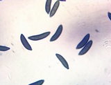 Xylaria cornu-damae image