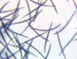 Trichoglossum variabile image