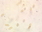 Boletus chrysenteron image
