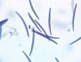 Geoglossum difforme image