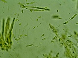 Leotia viscosa image