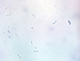 Chlorencoelia torta image