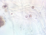 Thelephora multipartita image
