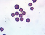 Scleroderma areolatum image