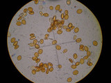 Pachylepyrium carbonicola image