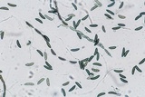 Xylaria cornu-damae image