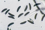 Xylaria cornu-damae image