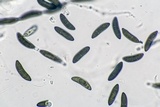 Xylaria cornu-damae image