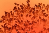 Berkleasmium conglobatum image