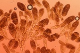 Berkleasmium conglobatum image