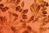 Berkleasmium conglobatum image