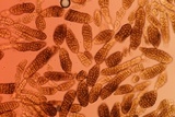Berkleasmium conglobatum image