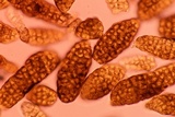 Berkleasmium conglobatum image