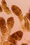 Berkleasmium conglobatum image
