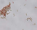 Hysterangium separabile image