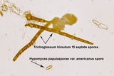 Hypomyces papulasporae image