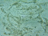 Diatrypella favacea image