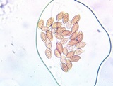 Hemistropharia albocrenulata image
