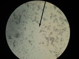 Melanoleuca verrucipes image