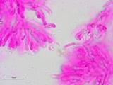 Galzinia incrustans image