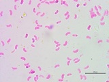 Galzinia incrustans image