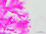 Galzinia incrustans image