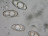 Peziza badia image