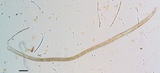 Tolypocladium ophioglossoides image