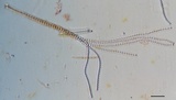 Tolypocladium ophioglossoides image