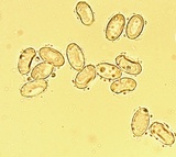 Morchella americana image