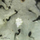 Hypotrachyna livida image