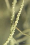 Usnea ceratina image