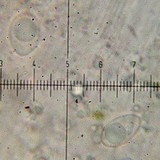 Lecanora hybocarpa image