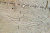 Bacidia schweinitzii image