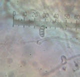 Dacryopinax elegans image