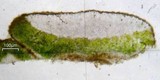Candelariella citrina image