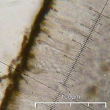 Candelariella rosulans image