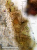 Peltula patellata image