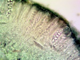 Lecanora meridionalis image