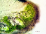 Lecanora meridionalis image