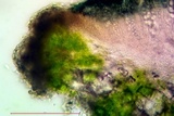 Lecanora meridionalis image