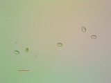 Lecanora meridionalis image