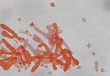 Tetrapyrgos nigripes image