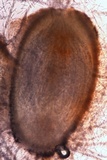 Tolypocladium longisegmentatum image
