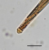 Tolypocladium longisegmentatum image